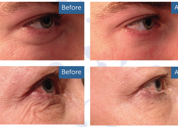 True science anti aging cream with Jackie Pack (part 1)